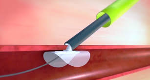 Image for Peripheral vascular device Market Size to Rapid Growth and Forecast till 2025 with ID of: 3333758