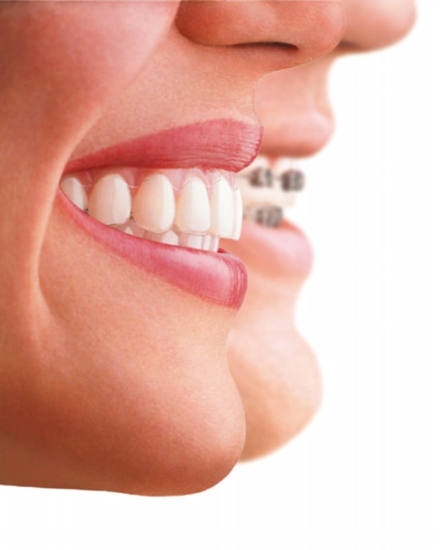 Image for Metro Dental with ID of: 3345314