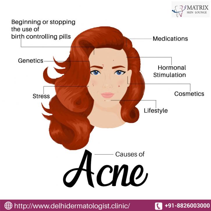Image for Acne Treatment in Vasant Vihar with ID of: 3354327