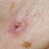 Image for My Skin Centre with ID of: 3357263