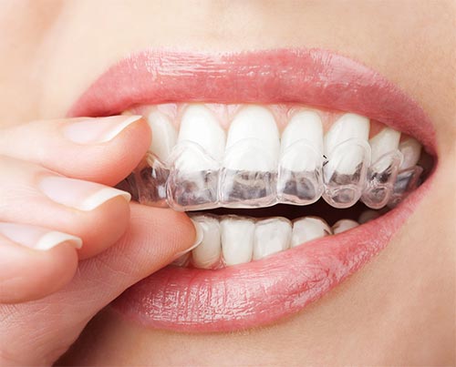 Image for Putnam Bright Smile with ID of: 3362018