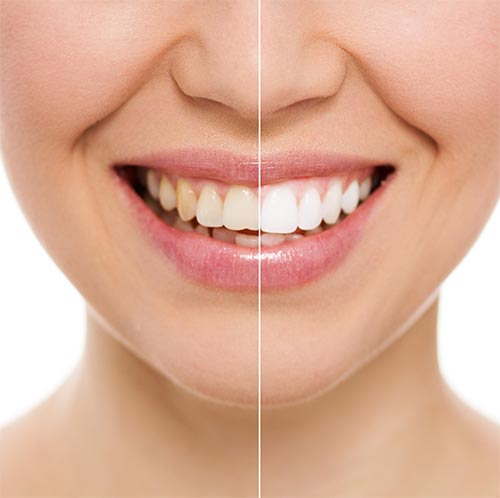 Image for Putnam Bright Smile with ID of: 3362019