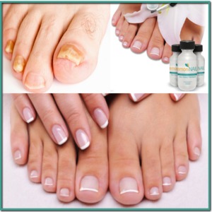 Image for Emoninail with ID of: 3365168