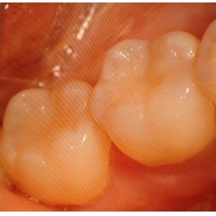 Image for Peyton Dental & Orthodontics with ID of: 3366518