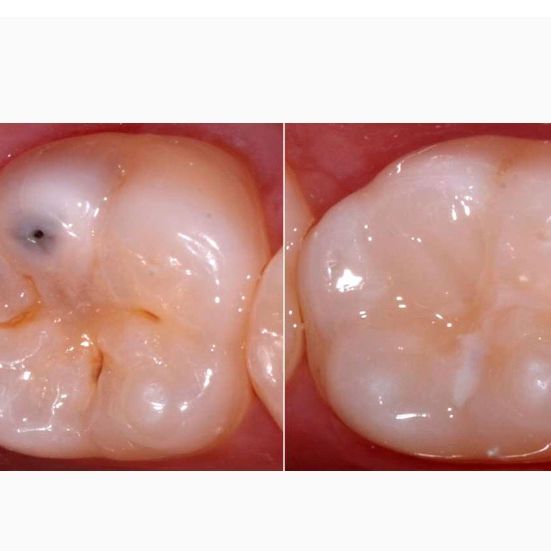 Image for Peyton Dental & Orthodontics with ID of: 3366544