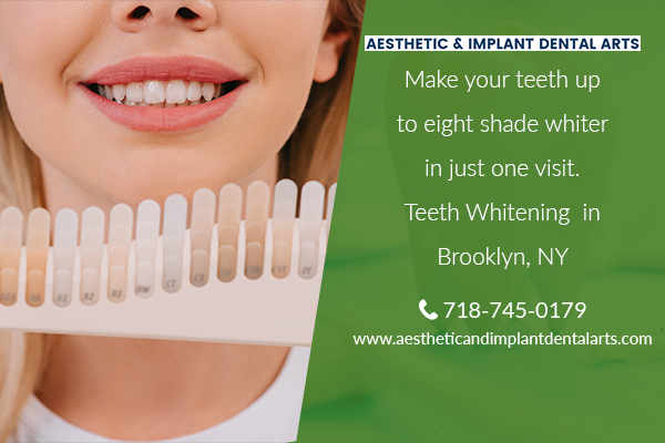 Image for Choosing the Best Teeth Whitening Procedure with ID of: 3373009