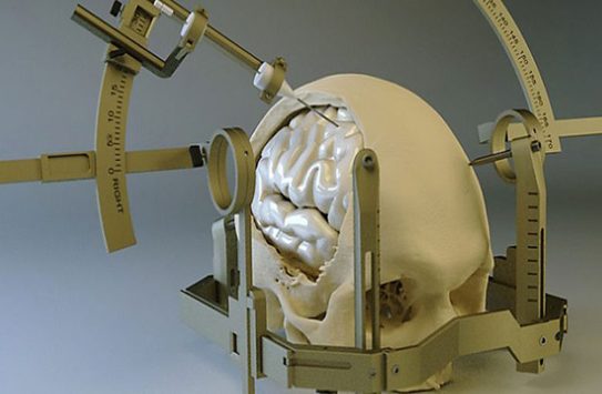 Image for Stereotactic Systems Market- Size, Share, Outlook, And Analysis 2018–2026 with ID of: 3374946