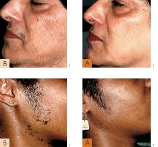 Image for Deluxe Laser and Spa with ID of: 3384325