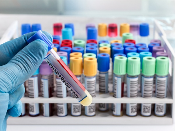 Image for Autoimmune Disease Diagnostics Market 2026 - Diagnostic Testing and Interpretation of Tests with ID of: 3387106