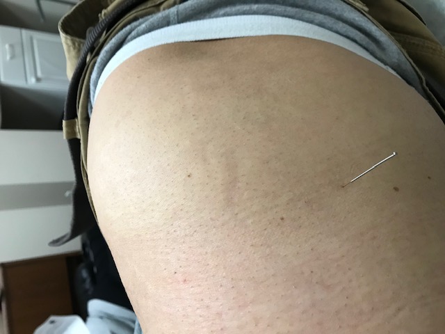 Image for Acupuncture Tao with ID of: 3391951