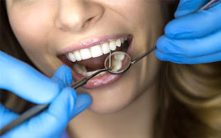 Image for Affordable Dental Implants Albany with ID of: 3394255