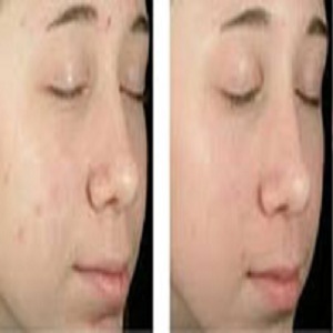 Image for Sleep Apnea with ID of: 3396050