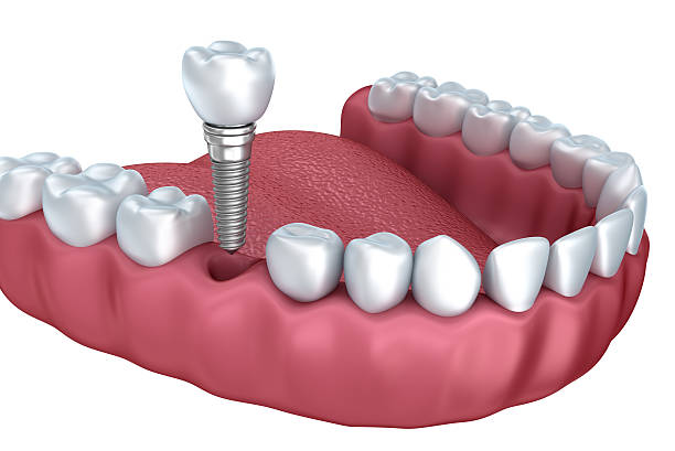 Image for Smile Savers Dentistry with ID of: 3405085