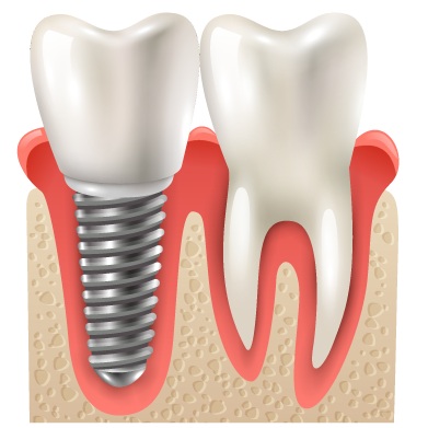 Image for Walk In Dentist No Insurance with ID of: 3414087