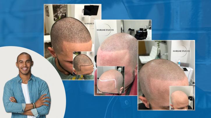 Image for Hairline Studios with ID of: 3414811