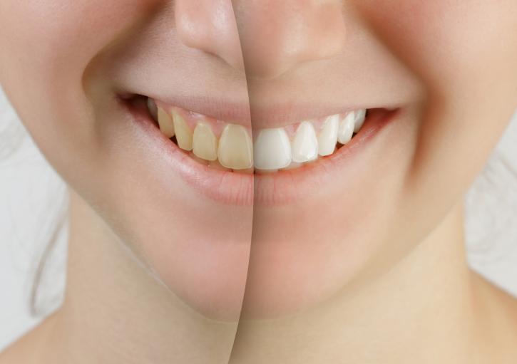 Image for Dentistry at Waterview with ID of: 3433963