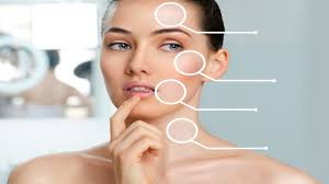 Image for Facial Implants Market 2018: Global Industry Analysis, Growth, Trends and Forecast To 2026 with ID of: 3440210