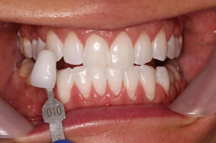 Image for Kruyer Dental with ID of: 3444273