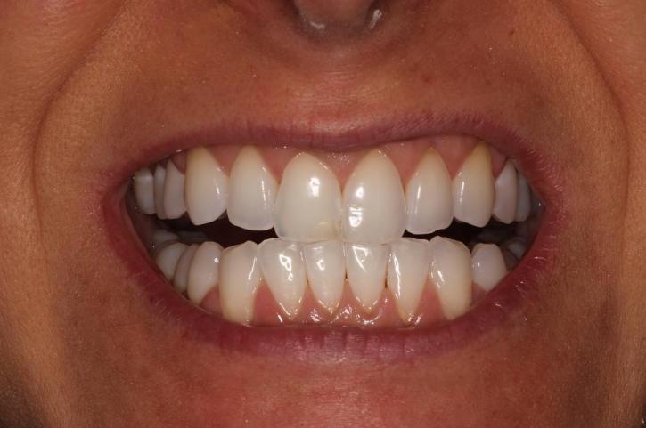 Image for Kruyer Dental with ID of: 3444363