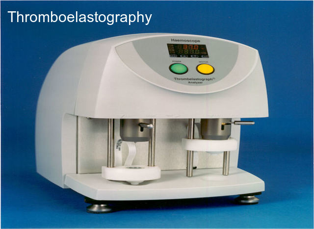 Image for Thromboelastography Machine Market – Size, Trends, Outlook, and Forecast, 2018-2026 with ID of: 3450617