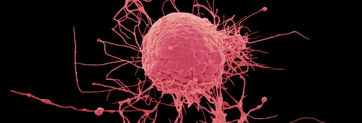 Image for Autologous Stem Cell and Non-Stem Cell Based Therapies Market Growth Analysis to 2026 with ID of: 3450724