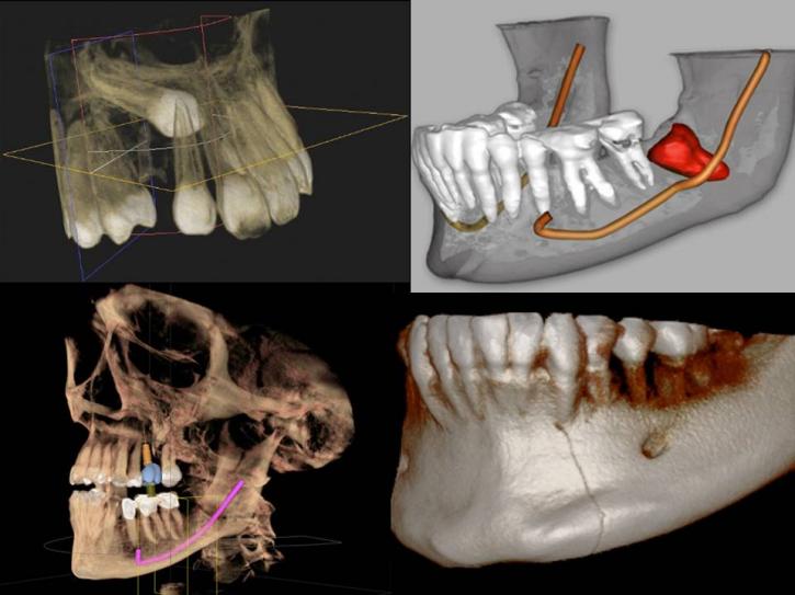 Image for CBCT Dental Imaging Market Report Segmented By Type Of Detector, Application And Geography To 2025 with ID of: 3451750