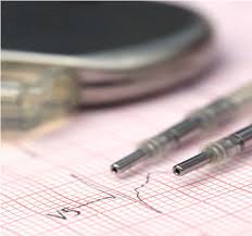 Image for Active Implantable Medical Devices Market Study By Product & Top Key Players - Abbott Laboratories, Biotronik Se & Co., Kg., Boston Scientific Corporation, Cochlear Limited with ID of: 3458656