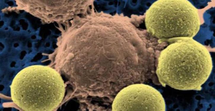 Image for antibody engineering with ID of: 3470194