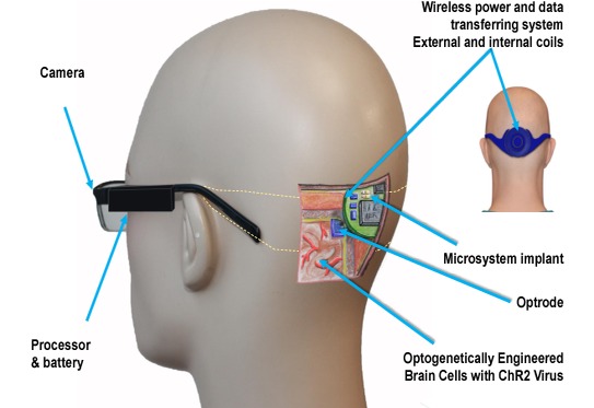 Image for Wireless Visual Cortical Stimulator Market - Size, Share, Trends, Outlook, and Analysis, 2018-2026 with ID of: 3481655