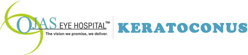 Image for Keratoconus treatment in India with ID of: 3485621