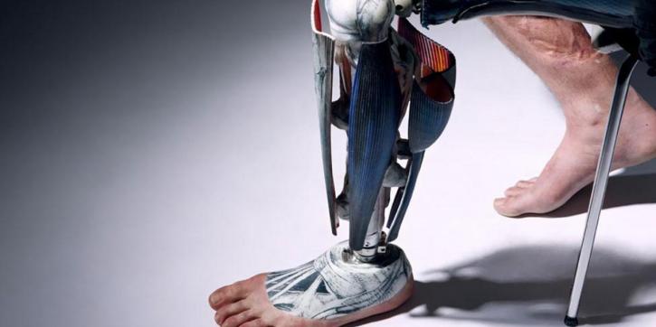 Image for Prosthetic Legs Market Study By Product Type, Technology & Top Key Players - Blatchford Ltd., Hanger Inc., Ossur Rg, Otto Bock HealthCare GmbH, The Ohio Willow Wood Co. with ID of: 3485967