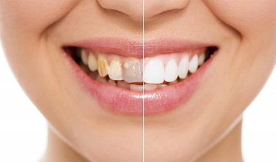 Image for Best Dentist Guide with ID of: 3491977