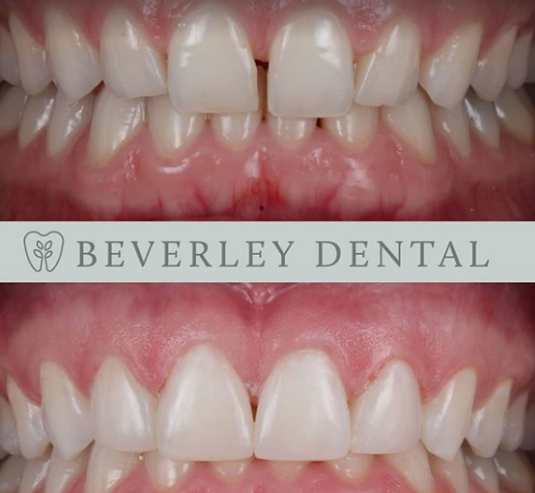 Image for Beverly Dental with ID of: 3493194