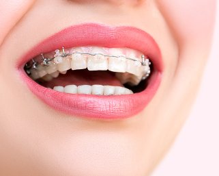Image for Orthodontic Experts with ID of: 3499438