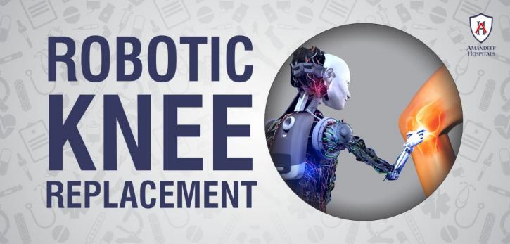 Image for Robotic Knee Replacement Surgery Hospital in Amritsar with ID of: 3500764