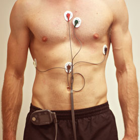 Image for Medical Electrodes Market Study By Type, Application & Top Key Players - 3M Company, Ambu A/S, C. R. Bard, Inc., Cognionics Inc., CONMED Corporation, Cooper Surgical, Inc. with ID of: 3500870