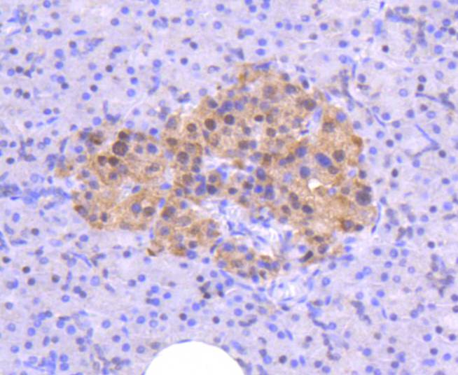 Image for bcl10 antibody with ID of: 3505594