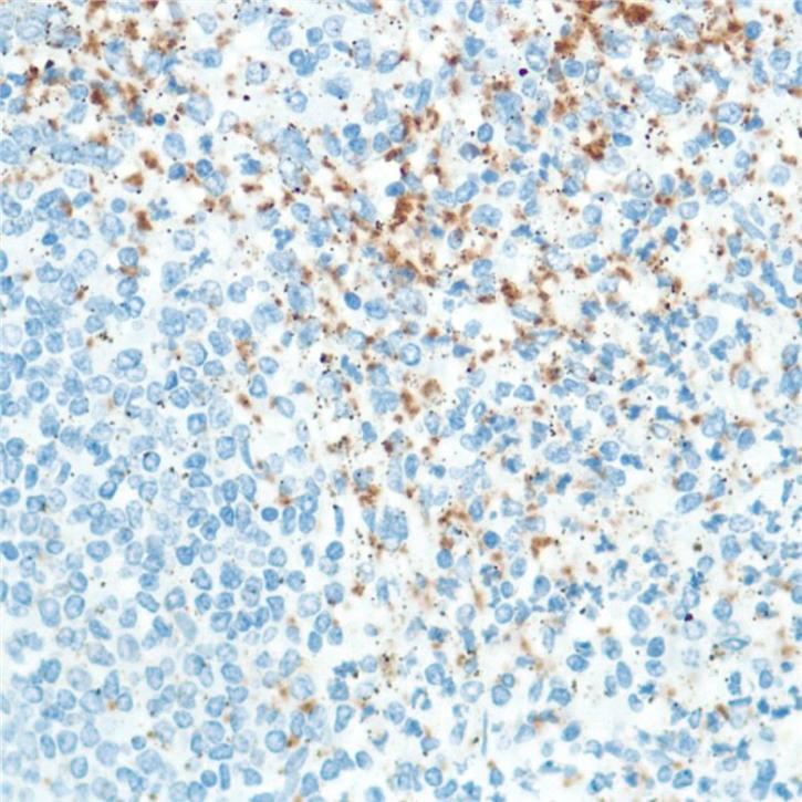 Image for cd42b antibody with ID of: 3505601