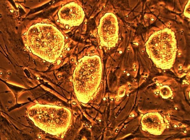 Image for Stem Cell Assay Market: Evolving Technology, Trends and Industry Analysis 2026 with ID of: 3518962