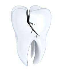 Image for Same Day Teeth Cleaning with ID of: 3522976