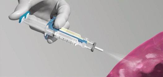 Image for Fibrin Glue Market Study By Application & Top Key Players - Baxter International Inc., CryolifeInc, CSL Behring, Haemcure Corporation, Interpore Cross with ID of: 3527170