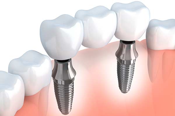 Image for Ryan Senft, DDS with ID of: 3533493