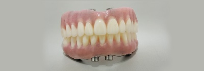 Image for Custom Dental Prosthetics with ID of: 3533961