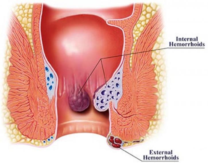 Image for Colonoscopy and Endoscopy Center- Upper East Side with ID of: 3548358