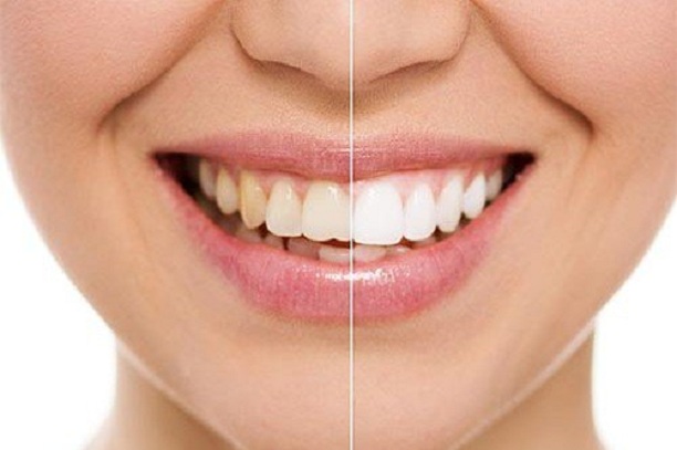 Image for Sparkle Dental with ID of: 3564281