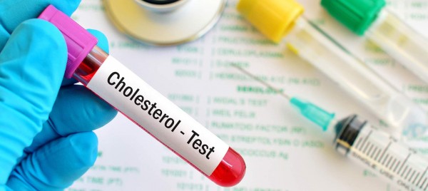 Image for Cholesterol Testing Services Market Trends Research And Projections For 2018-2026 with ID of: 3565988