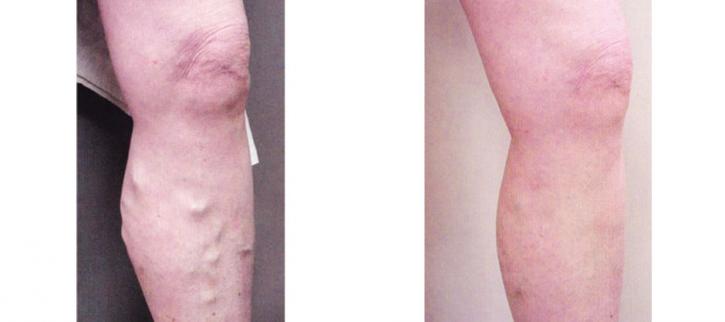 Image for Northeast Vein & Laser Center with ID of: 3568826