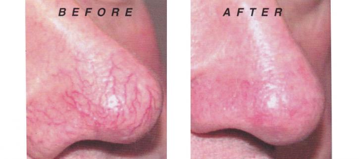 Image for Northeast Vein & Laser Center with ID of: 3568832