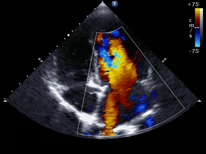 Image for Echocardiography Market Study By Product Types, Technology & Top Key Players - GE Healthcare, Koninklijke Philips, Siemens Healthcare with ID of: 3578036
