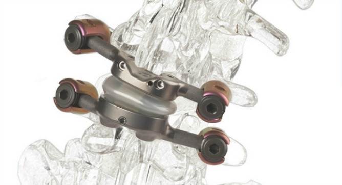 Image for Spinal Implants and Surgical Devices Market Size, Trends & Industry Research Report 2018-2025 with ID of: 3584048